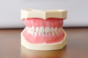 部分矯正はどの歯までできる？