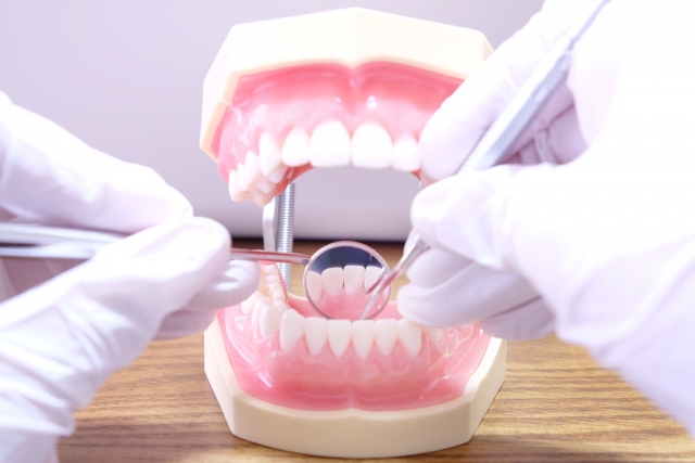 前歯の裏に歯石が！歯周病の原因になることも
